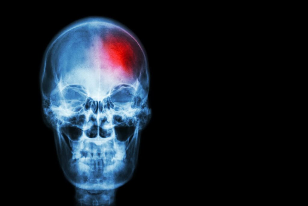 an x-ray of a skull
